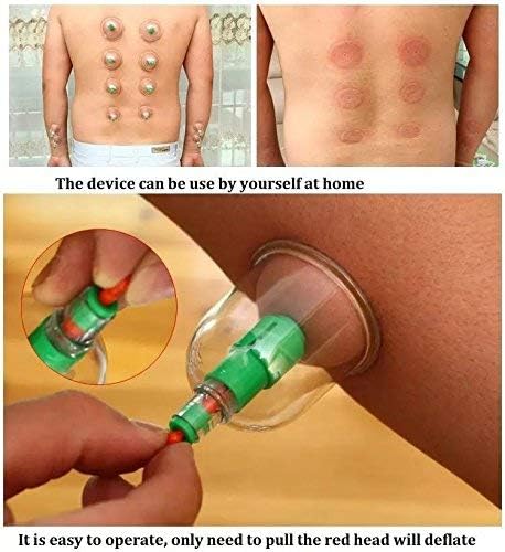 KN - Pull Out Vacuum Apparatus